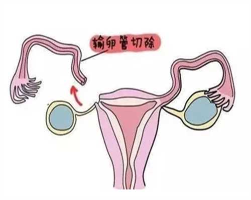 <b>武汉代孕的地方,武汉供卵试管婴儿医院取卵移植的流程是怎样的？</b>