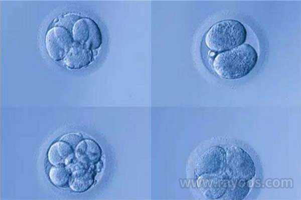 新余代孕机构排名,囊胚培养，做试管婴儿我们是否需要养囊？-做试管取卵前可