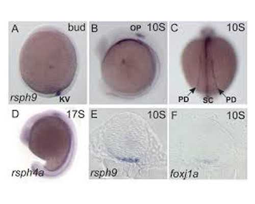 武汉代生孩子犯法吗,武汉协和医院-武汉试管婴儿收费标准