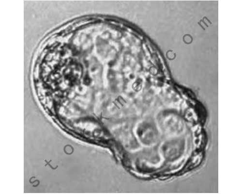 武汉代孕机构的流程,武汉试管三代包生男孩医院一览，附试管助孕费用明细！