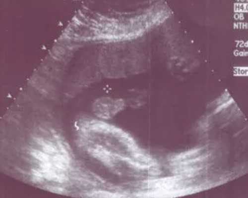 武汉试管代孕公立医院,武汉三代供卵试管医院排名？附试管助孕机构一览？