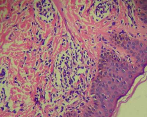 武汉供卵女孩年龄,武汉协和医院-武汉试管婴儿收费标准