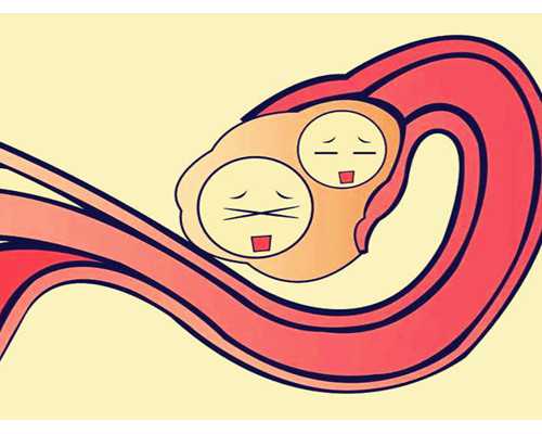 三代试管最好的医院_代妈跑了怎么办,一次说清楚，赴泰国试管的条件_试管孕早