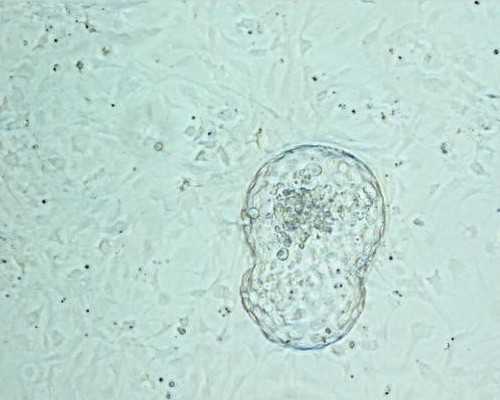 50岁借卵子助孕_世纪代妈,想要二胎，去泰国做试管婴儿多少钱？会很贵吗？_中