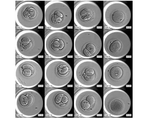 武汉知名代孕公司,武汉正规供卵试管医院,武汉正规供卵机构