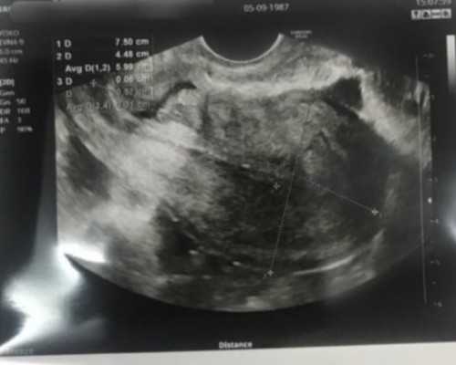 武汉大学生供卵包,武汉三代试管包成功，武汉试管找哪个医生