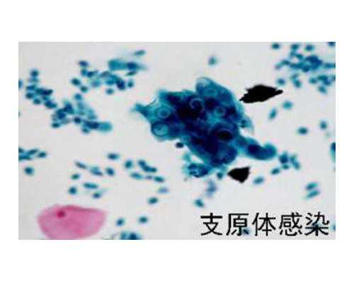 武汉哪儿医院有代孕,[武汉试管医生排名]武汉做试管医院排名