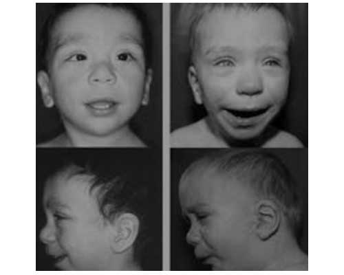 试管婴儿怎样取卵子？试管取卵越多越好吗？