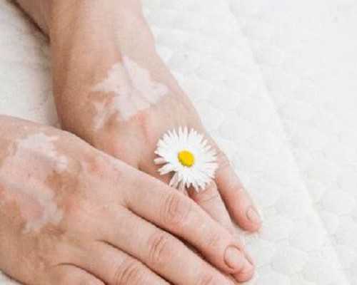 染色体易位分几种