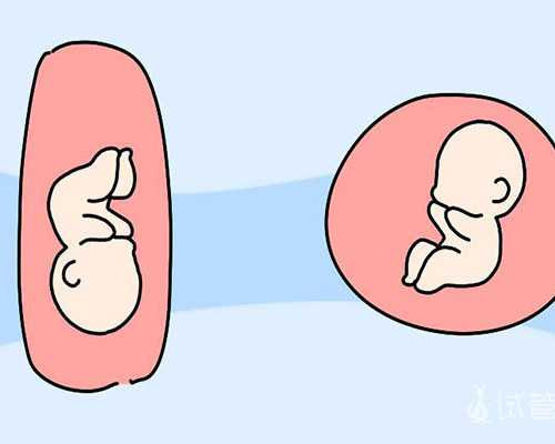 梗阻性无精症的定义