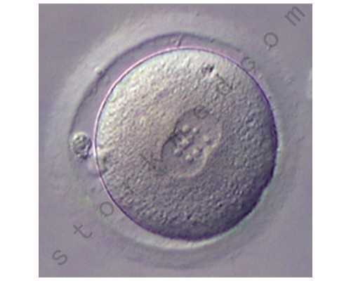 胚胎停育hcg会翻倍吗,试管代怀供卵