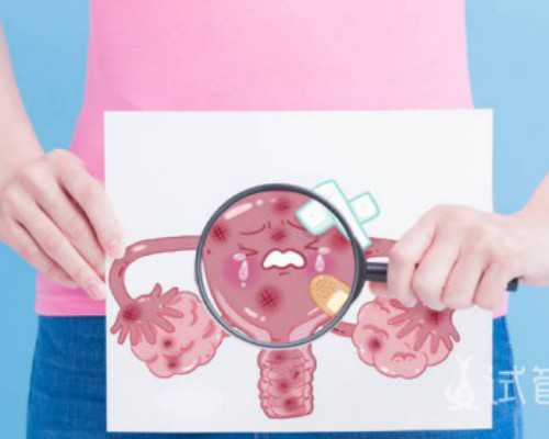 2026代妈价格_三代试管适应症色盲,巧克力囊肿做泰国试管前是否要打闭经针？