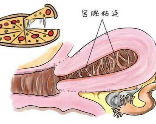 武汉代孕生双胞胎多少钱,武汉供卵助孕机构告诉你，三代试管能解决FSH高吗？