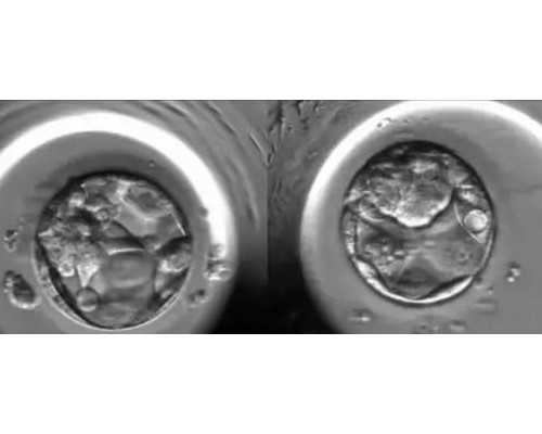 365助孕_三代供卵试管,北京第三供卵试管中心有哪些试管医院？_阴超和b超检查