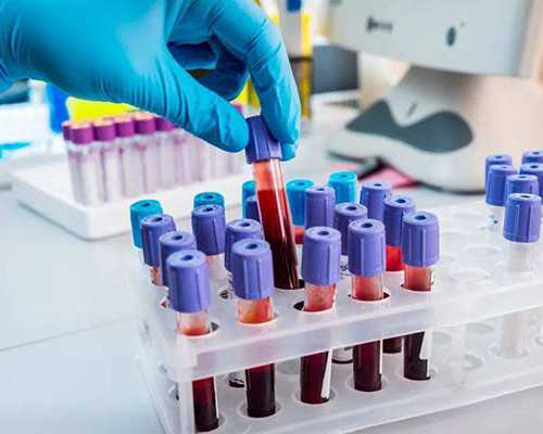 <strong>胚胎停止发育：胚胎停止发育的前兆</strong>