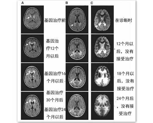 <strong>51宝贝助孕机构_35万代孕包男女,还在纠结怎么选择泰国试管方案？不用费力，做</strong>