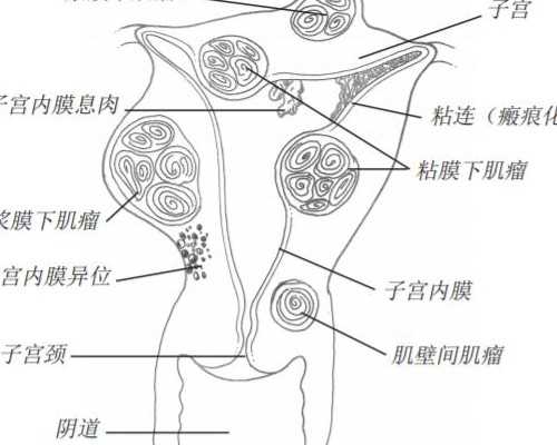 武汉代孕哪家口碑好,武汉同济医院(武汉同济试管)