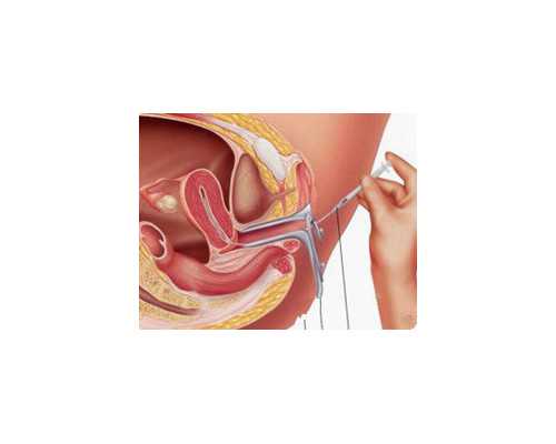 世纪供卵_40岁供卵试管婴儿,泰国第三代试管婴儿能避免唐氏综合征吗？-上海瑞