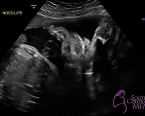 三代试管助孕_人工受孕多少费用,北京做试管婴儿去哪里做呢？北京家圆医院