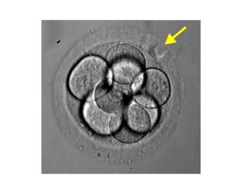 武汉去哪里找代生孩子,武汉买卵子生孩子