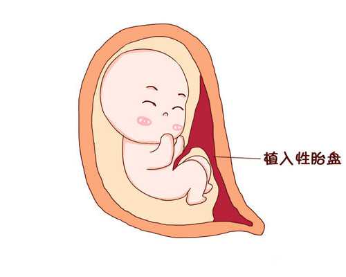 武汉代怀价格表,武汉供卵助孕妈妈,武汉供卵代孕取卵费用和取卵个数有关系吗