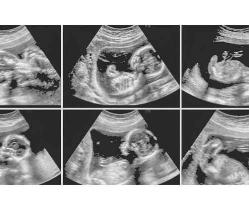 中国靠谱的代生机构_上思代孕选男女,为什么取卵个数这么少 北京试管婴儿哪个