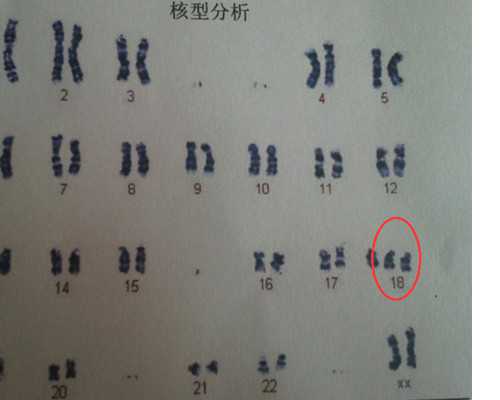 武汉供卵试管婴儿贵吗,武汉供卵试管婴儿费用