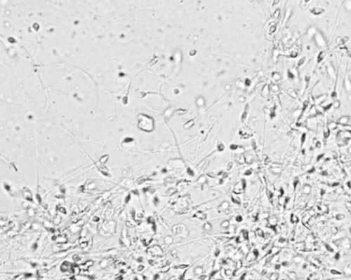 怀孕一个月怎么流产_育儿嫂中介公司加盟,助孕期间感冒了，我该怎么办？