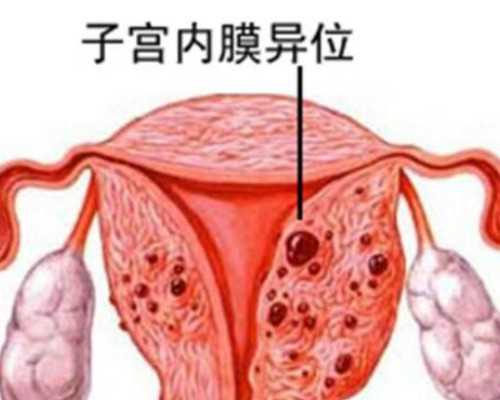 怀孕可以药物流产吗_备孕前准备吃什么,做试管婴儿助孕生男生女可以自己选择
