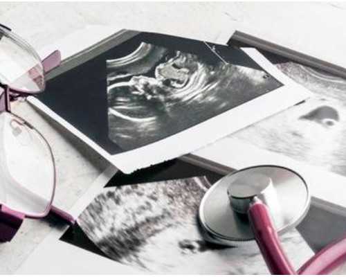 武汉供卵代孕借卵生子,武汉协和医院供卵代孕婴儿技术成功率是多少，费用大