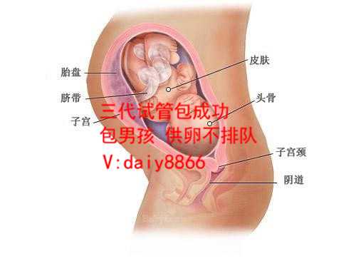 贵阳供卵生子_婴儿试管详细步骤:广州治疗输卵管堵塞价格