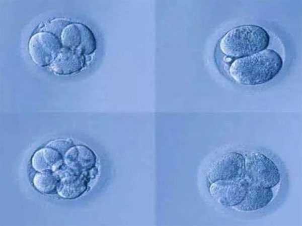 湘西乐宝助孕网站_试管婴儿优胚和普胚的区别，一览本文即可熟知